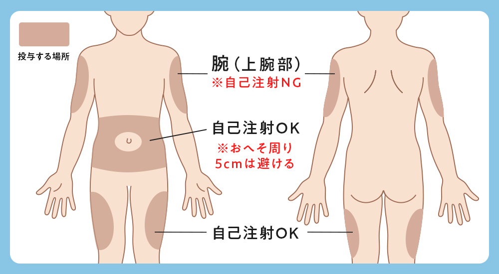 マンジャロ打つ場所